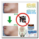 消除疙瘩體質祛增生性凹凸手術產后去開刀割傷疤痕印縫針精油產品