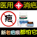 軟化增生性疙瘩祛除舊凹凸巴煙燙消去燒傷疤痕印淡化黑色素藥產品