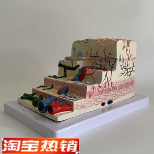 胃粘膜放大模型胃壁層次血管淋巴管胃鏡教學消化科醫生示教醫藥促