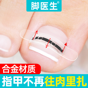 腳醫生甲溝嵌甲矯正器炎正甲貼貼片腳趾指甲往肉里長專用指甲刀剪
