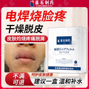 電焊工臉灼傷發紅干燥脫皮刺痛專用皮膚護理補水面膜藥房同售kj